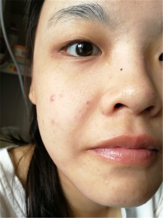 宣致蜗牛原液精华液亲身使用感受，保证是真实经历 实话实说  精华液护肤 第4张