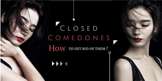 真正有效的祛痘产品排行榜10强，从丑小鸭到大白鹅全靠它们