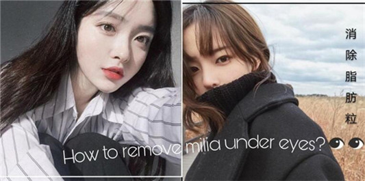 脂肪粒怎么去掉，去脂肪粒效果好的眼霜排行榜