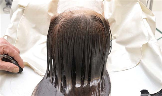 头皮屑多怎么去除最简单方法