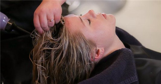 头皮屑多怎么去除最简单方法  头皮屑 第2张