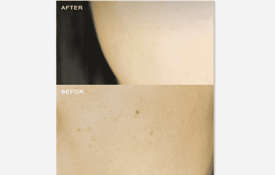 欧莱雅安瓶精华的作用是什么，七天让你的肌肤焕然一新  欧莱雅 精华液 第6张