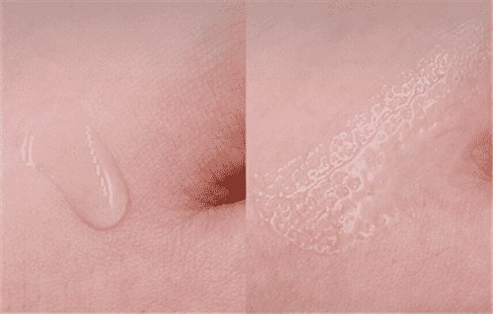 欧莱雅安瓶精华的作用是什么，七天让你的肌肤焕然一新  欧莱雅 精华液 第7张