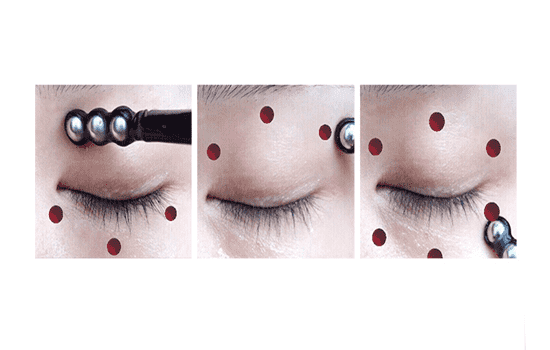 欧莱雅小黑瓶眼霜使用方法，需要搭配**头使用哟  欧莱雅 眼霜 第2张