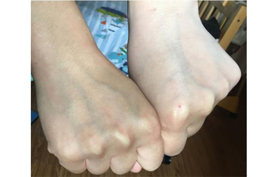 欧莱雅气垫cc霜好用吗，奇焕光采隔离气垫CC霜测评  气垫粉底 CC霜 欧莱雅 第4张