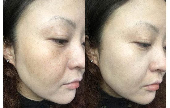 欧莱雅气垫cc霜好用吗，奇焕光采隔离气垫CC霜测评  气垫粉底 CC霜 欧莱雅 第5张