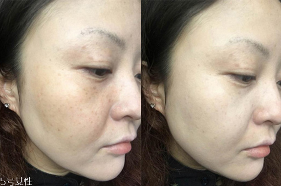 欧莱雅气垫好用吗，欧莱雅气垫cc霜使用测评  欧莱雅 欧莱雅气垫好用吗 欧莱雅气垫cc霜 呼吸37度 第10张