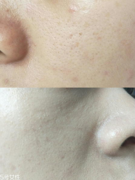 欧莱雅红胖子气垫有替换装吗，蔡徐坤最新代言气垫  欧莱雅 欧莱雅气垫 欧莱雅红胖子气垫 呼吸37度 第4张