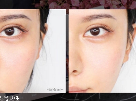 欧莱雅安瓶是白天用还是晚上用，欧莱雅安瓶用后搓泥原因  欧莱雅 欧莱雅安瓶是白天用还是晚上用 欧莱雅安瓶用后搓泥原因 呼吸37度 第6张