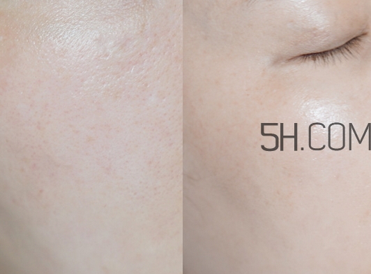 玉兰油大红瓶面霜和欧莱雅天才霜哪个好  玉兰油 欧莱雅 面霜 呼吸37度 第4张