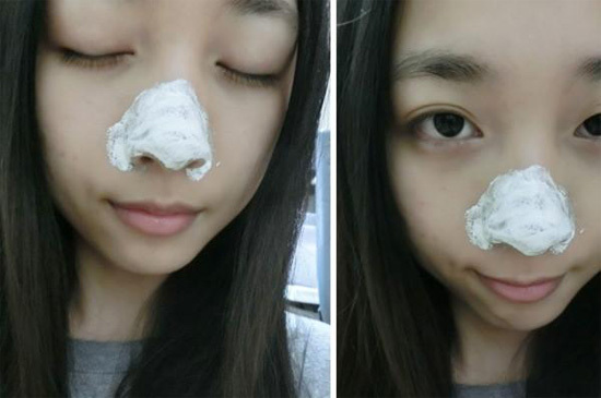 牙膏去黑头有用吗，牙膏去黑头的步骤和操作方法