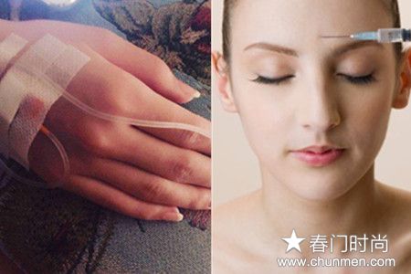 美白针可以维持多久，美白针价格昂贵而且需要后续护理  美白针 第2张