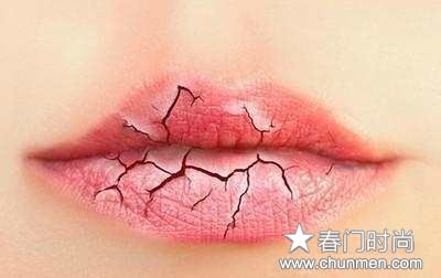 秋冬嘴唇干裂糜烂怎么回事，嘴上有裂口怎么办  嘴唇嘴唇干裂 第1张