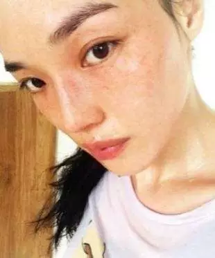 女人什么原因导致长斑，色斑形成的原因有哪些  色斑淡斑 第1张
