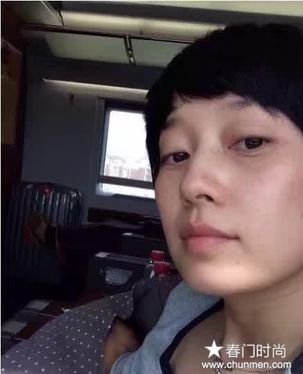 女人什么原因导致长斑，色斑形成的原因有哪些  色斑淡斑 第3张