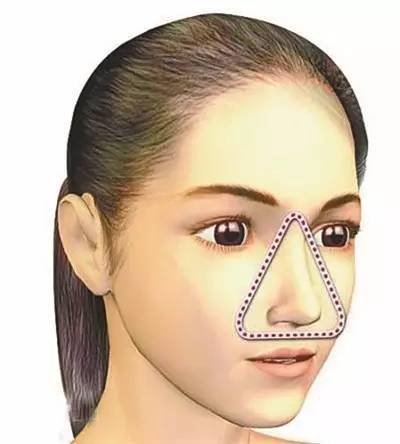 女子挤青春痘差点丢掉性命，危险三角区千万不要乱挤痘