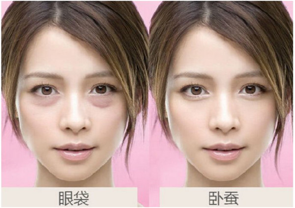 去眼袋的好方法，彻底去除眼袋 马上年轻十岁