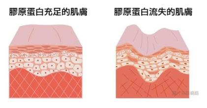 预防衰老，从胶原蛋白说起 保持胶原蛋白含量不会有皱纹