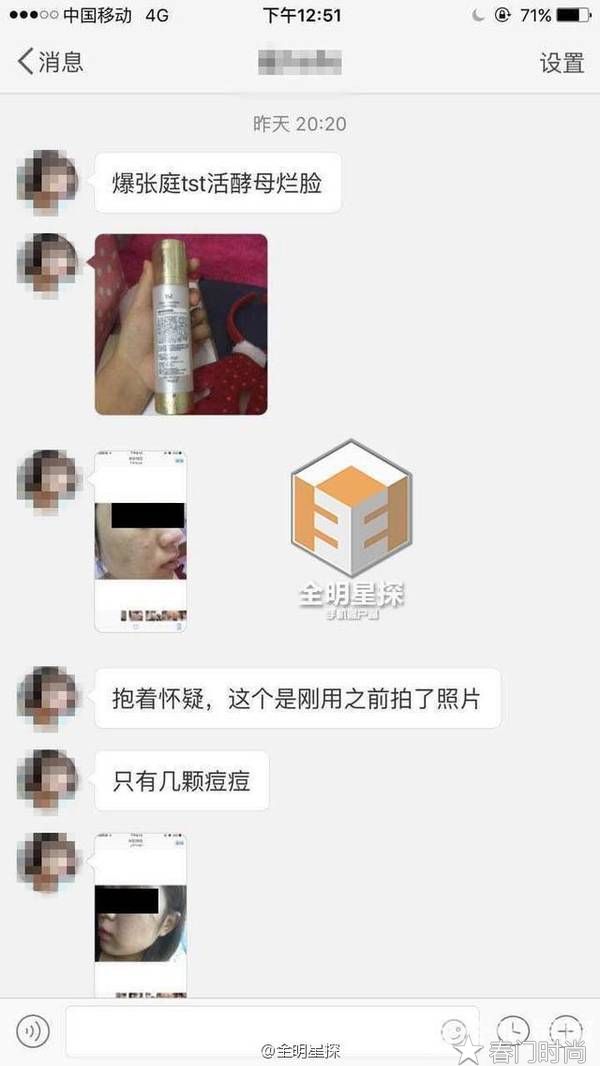 揭秘烂脸毁容的TST庭秘密，其实也是微商的本质  微商 第3张