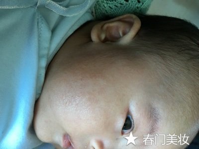 高大哥宝宝湿疹净，激素严重超标 号称军人，良心何在！