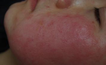 高大哥宝宝湿疹净，激素严重超标 号称军人，良心何在！  激素湿疹 第3张