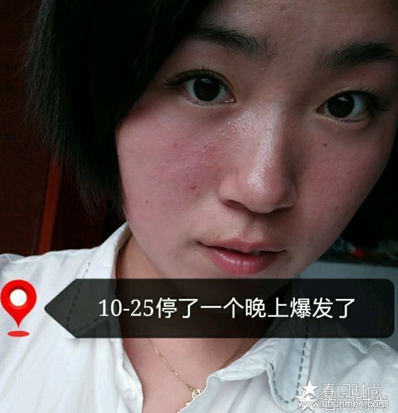 你你面膜怎么样，nini面膜有激素 你你面膜差点让我毁容