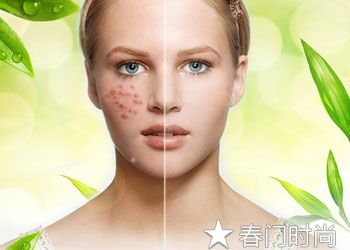 如何对抗面部痘痘，真的太实用了