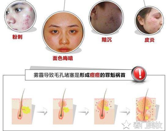 雾霾天护肤知识，这个时候看出你是不是爱护自己的人  护肤 第2张
