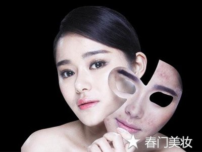 春门护肤之痘痘篇
