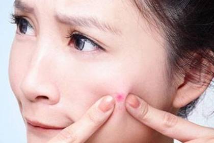 脸上长痘痘怎么调理才好，