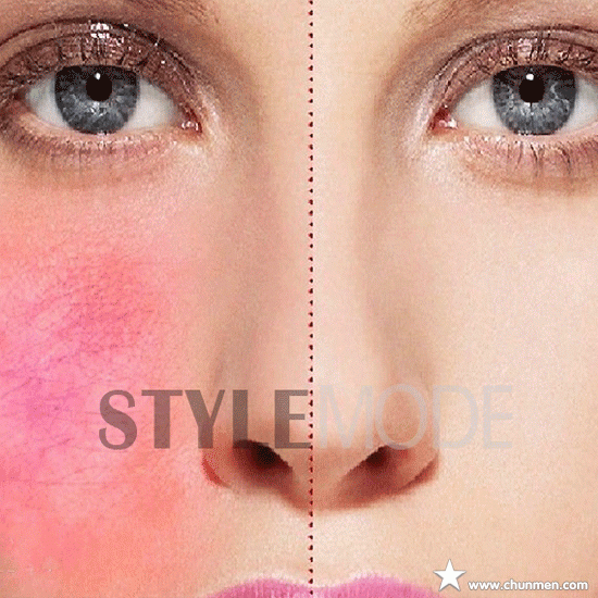 造成红血丝的原因居然是这些