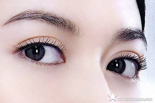 埋线双眼皮多久能恢复，