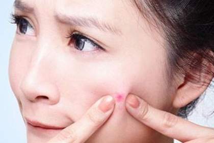 不同时期的痘痘的对应处理方式