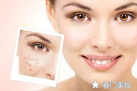 加强生活好习惯，让痘痘自己走