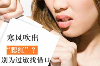 寒冷季节如何应对红血丝