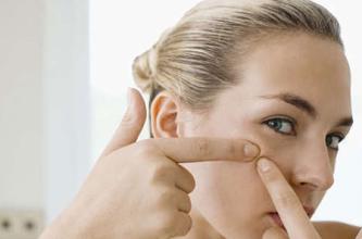 痘痘里面白色东西是什么，能不能挤出来