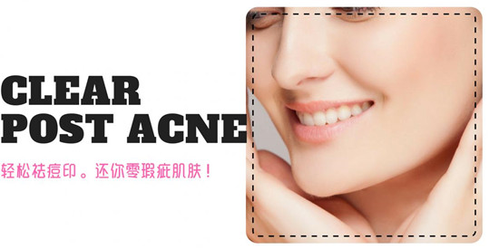 真正好用有效的祛痘去印产品排行榜10强，让肌肤回到过去