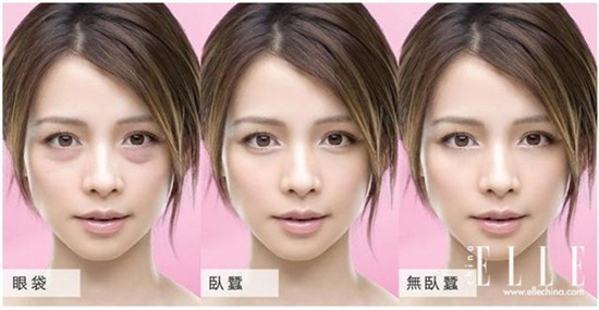 效果好口碑高的去眼袋眼霜排行榜，去眼袋你可千万不要去动手术