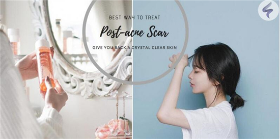 抗衰老去皱纹精华液瓶排行榜10强，紧致肌肤重塑精致V脸