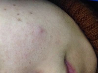 卡莎灡香皂用完直接毁脸，吹牛说是进口是个小作坊加工