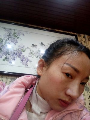 靓黛里水光针怎么样，靓黛里产品效果好吗