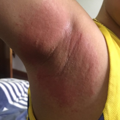 何氏狐臭净能根治吗,,何氏狐臭净怎么样, 健康知识化妆品评测狐臭 第2张 何氏狐臭净能根治吗,,何氏狐臭净怎么样, 健康知识化妆品评测狐臭 第2张