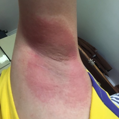 何氏狐臭净能根治吗,,何氏狐臭净怎么样, 健康知识化妆品评测狐臭 第4张 何氏狐臭净能根治吗,,何氏狐臭净怎么样, 健康知识化妆品评测狐臭 第4张