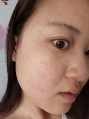 德德维芙面膜怎么样，面膜贴做工差容易过敏 谁用谁后悔