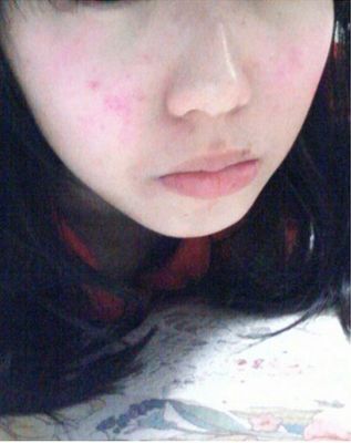 德德维芙面膜怎么样，面膜贴做工差容易过敏 谁用谁后悔  面膜化妆品评测 第4张