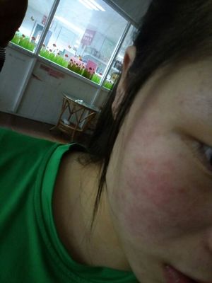 德德维芙面膜怎么样，面膜贴做工差容易过敏 谁用谁后悔  面膜化妆品评测 第5张