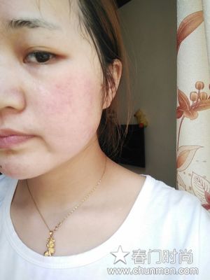 HomeFacialPro是什么牌子，玻尿酸原液效果怎么样