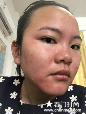 HomeFacialPro是什么牌子，玻尿酸原液效果怎么样  护肤品化妆品评测 第2张