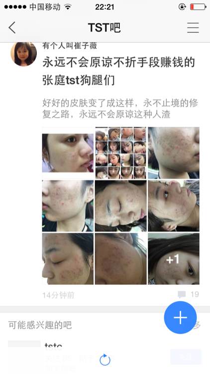 tst庭秘密产品怎么样，过敏的人都能组成一个战斗部队  护肤品护肤 第3张