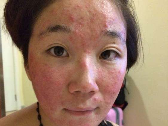 仟佰草面膜怎么样,非法添加激素被质检总局曝光 面膜激素 第2张 仟佰草面膜怎么样,非法添加激素被质检总局曝光 面膜激素 第2张